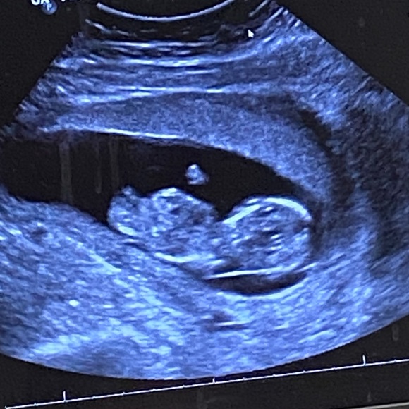 Meet your Posher, Ana from Cuero - Picture 3 of 4